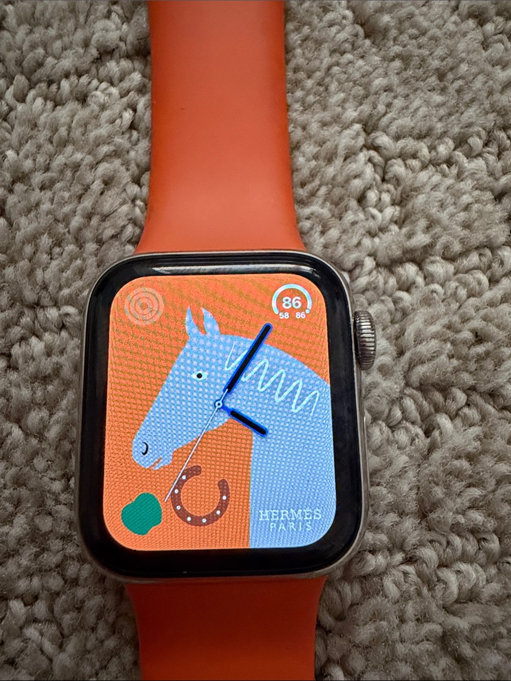Hermes/Apple Watch - Picture 4 of 4